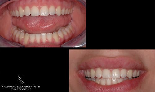 Studio Dentistico Nazzareno & Alessia Bassetti | Fine sorriso