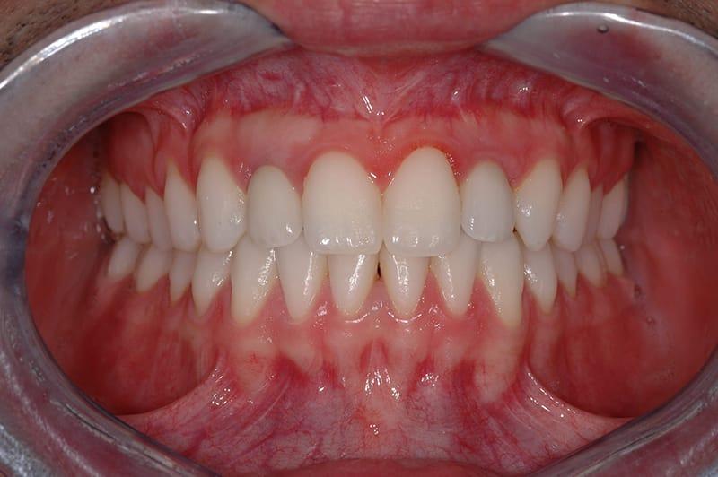 Corsi Clinici in Gnatologia