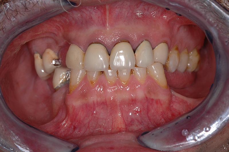 Corsi Clinici in Gnatologia