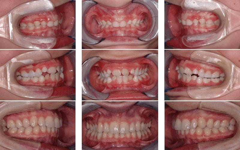 Corsi Clinici in Gnatologia